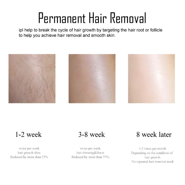 3 in 1 Ice Laser Epilator 999999 Flashes